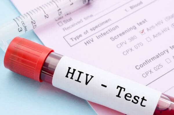 Tydzień badań na HIV