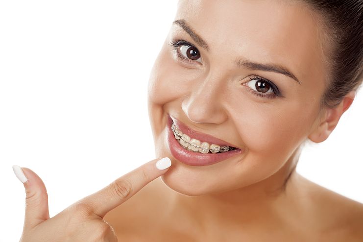 Jak dbać o zęby w aparacie ortodontycznym?