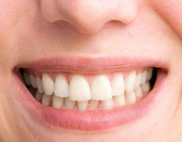 6 powodów, dla których warto dbać o zęby