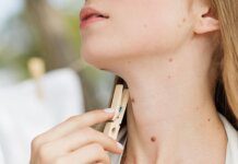 Po urlopie koniecznie wybierz się do dermatologa problemy skórne